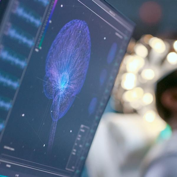 Monitors Show EEG Reading and Graphical Brain Model.